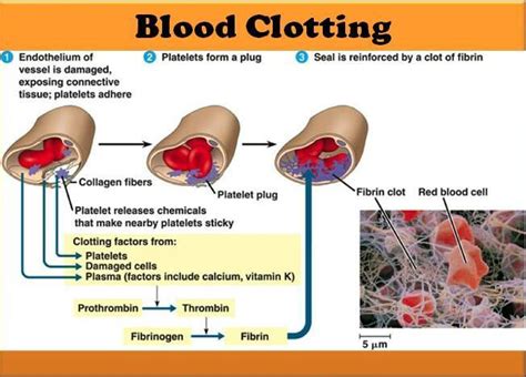 CLOTTY definition and meaning .
